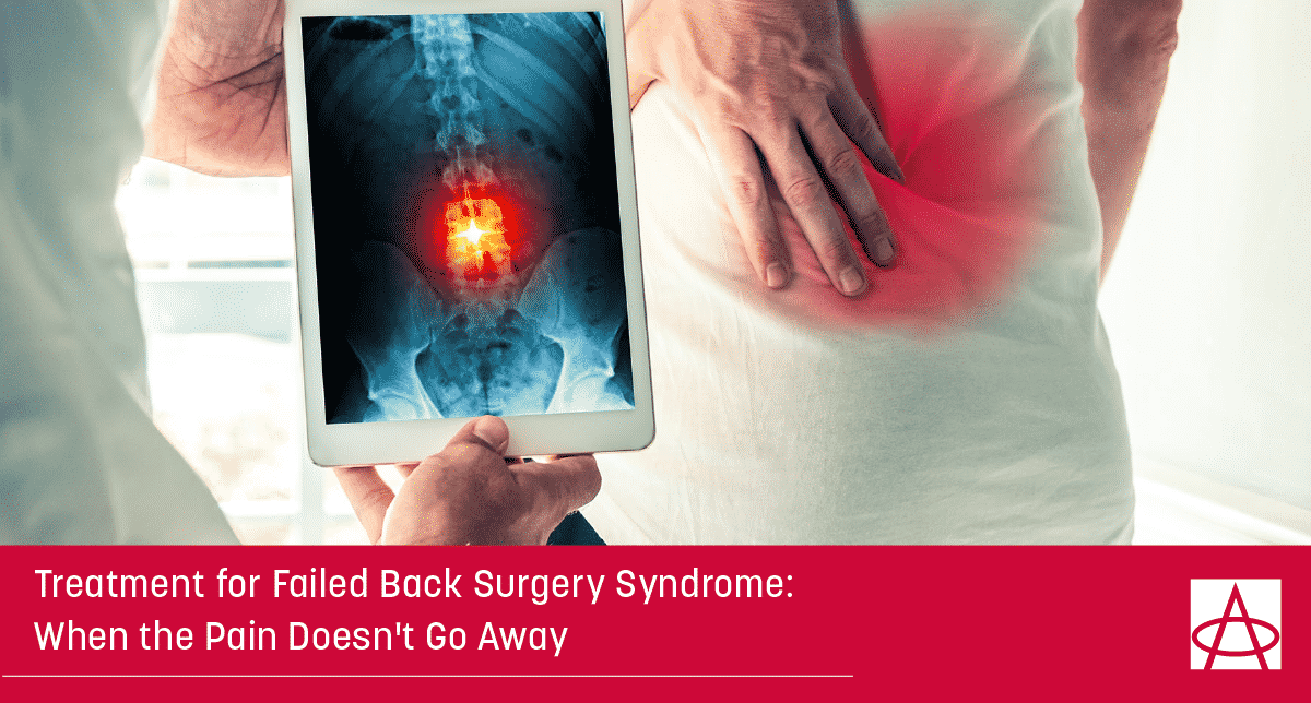 Treatment for Failed Back Surgery Syndrome: When the Pain Doesn't Go Away