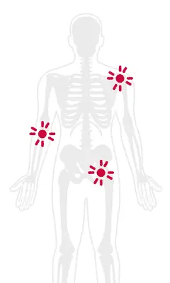 Degenerative Joint Disease Treatment