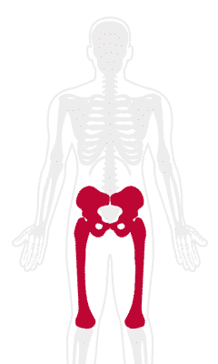 Hip Pain Treatment