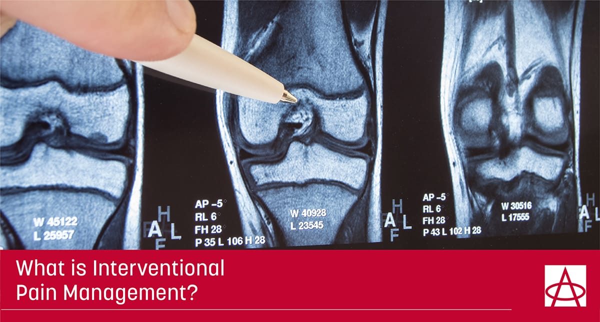 What is Interventional Pain Management?