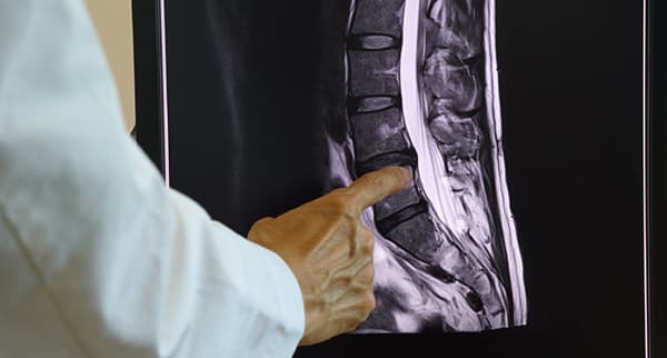 a doctor is pointing to an important spot on an MRI