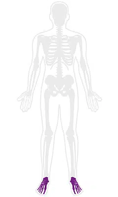 Gout
