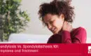 Spondylosis vs spondylolisthesis