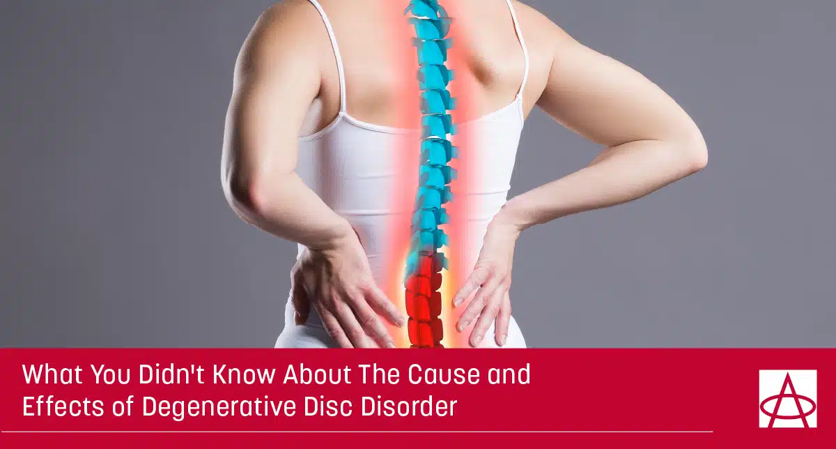 Image of patient with back pain.