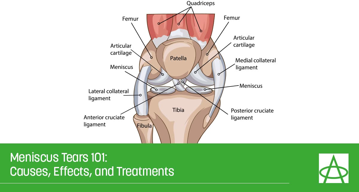 Chart of the knee.