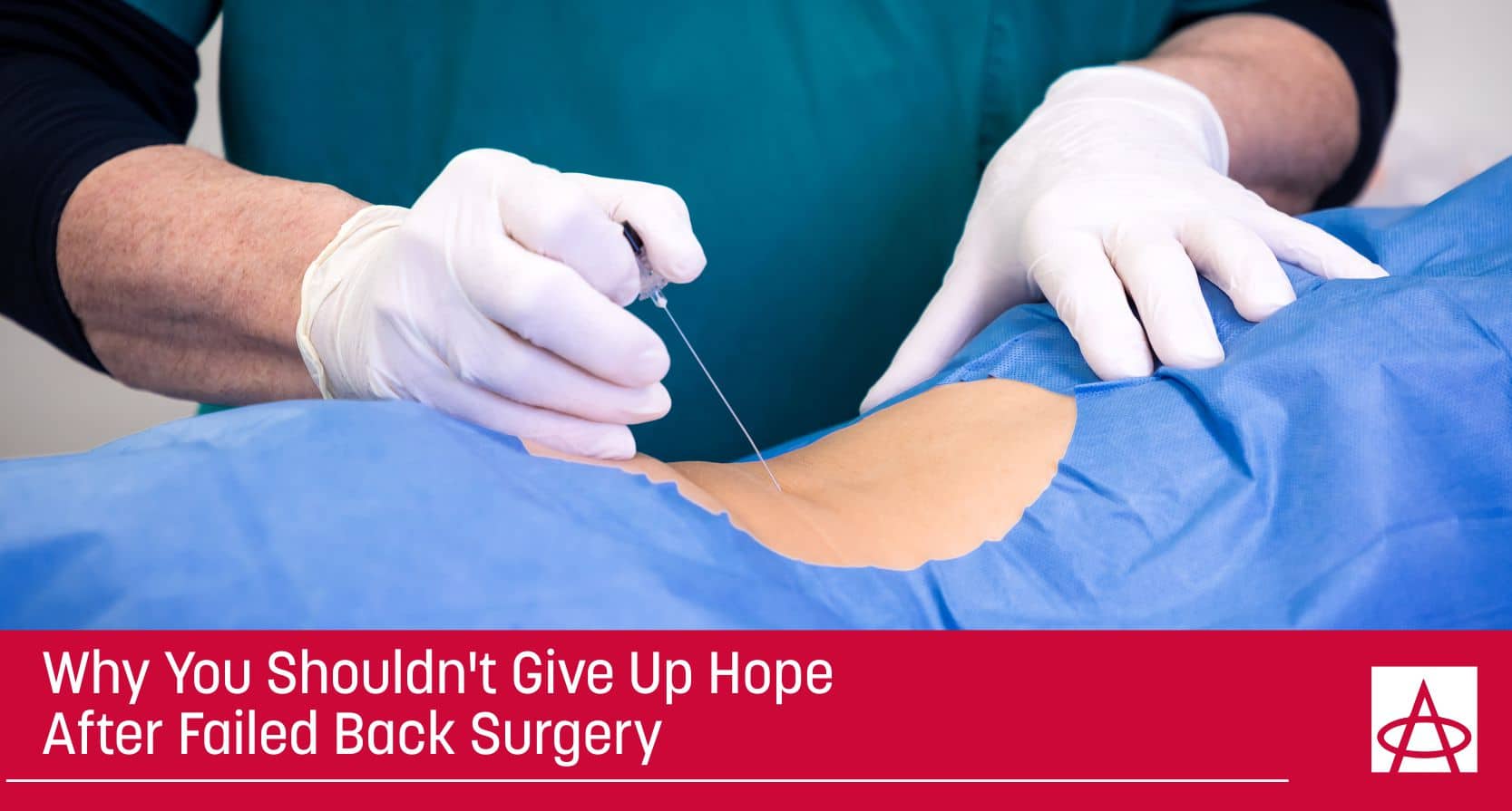 Failed back surgery syndrome