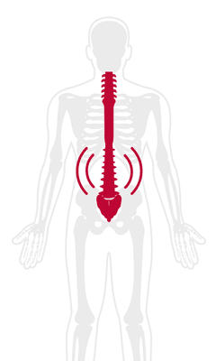 Epidural Steroid Injection for Back & Nerve Pain Relief