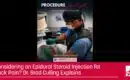 back pain treatment​-Dr-Brad-Culling